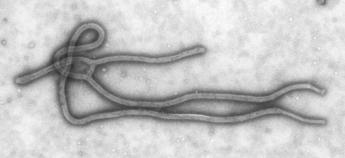 Medical director: Ebola protocol in place