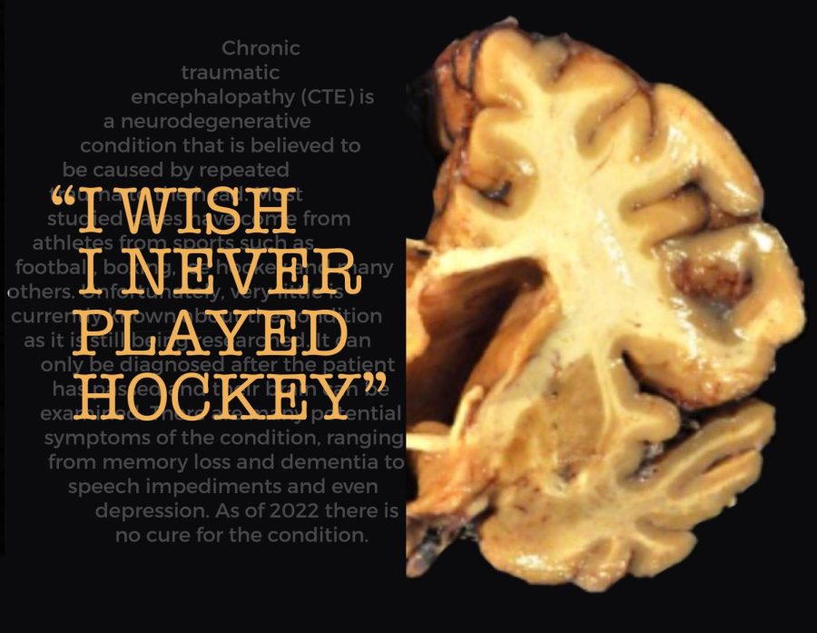 I+wish+I+never+played+hockey%3A+Former+QU+mens+hockey+player+reveals+life-threatening+effects+of+intoxicating+smashmouth+culture+that+has+him+searching+for+answers